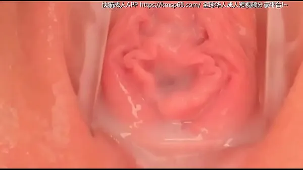 HD vaginal 驱动管