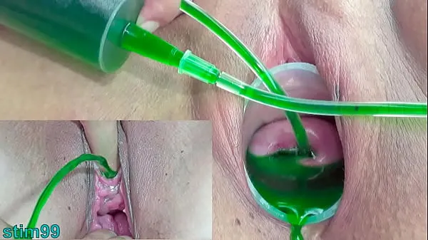 ایچ ڈی Cervix and Pee Hole Inflation with Injections for Japanese Lesbians ڈرائیو ٹیوب